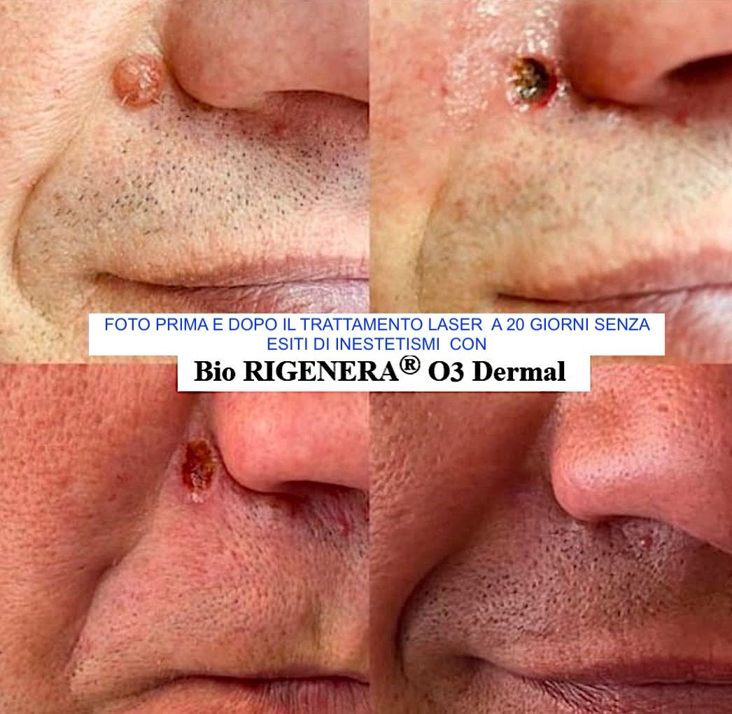 Bio RIGENERA Dermal Lipogel Bio Rigenerante e Bio Riparatore 25 ml - immagine 2